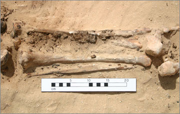 Figure 5. Tibiae and fibulae of Individual No. 23 showing remnants of textile